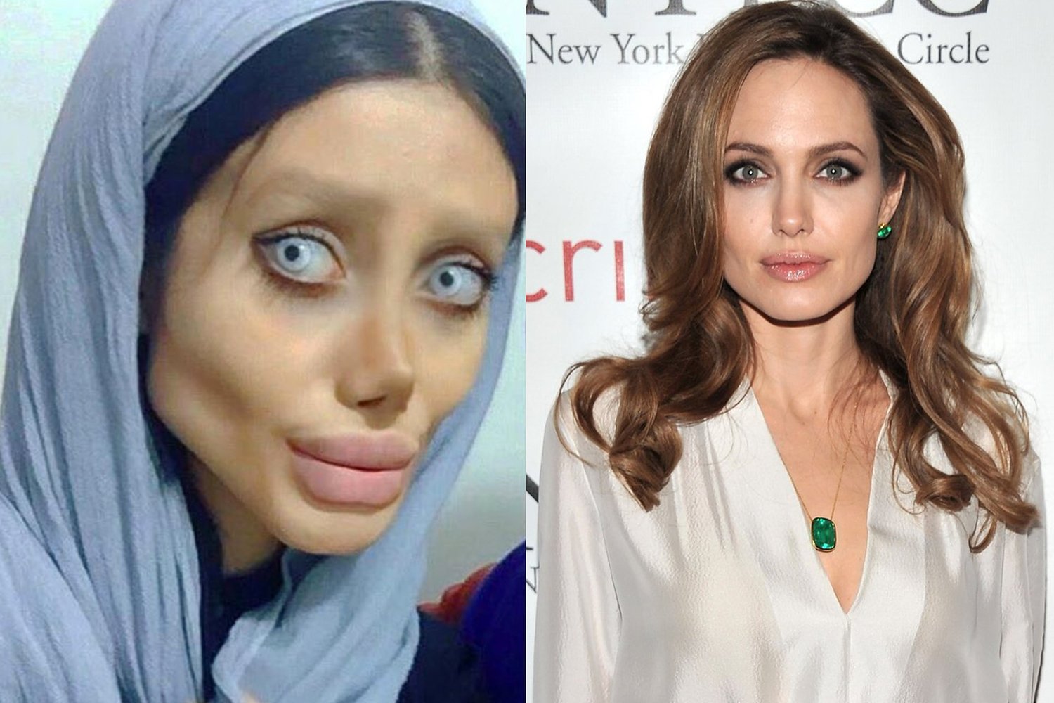 Angelina jolie lookalike plastic surgery