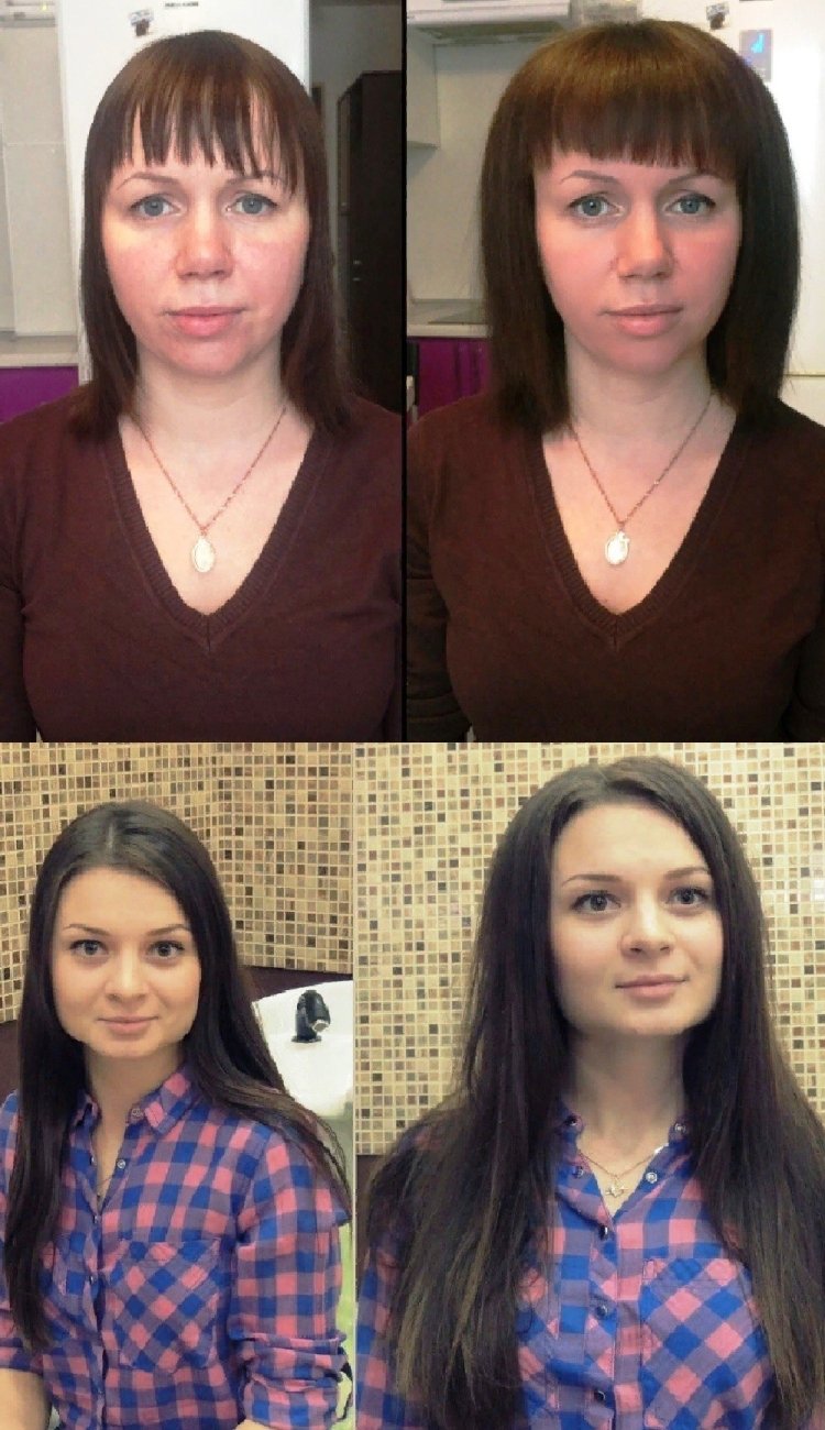 Прикорневая химия