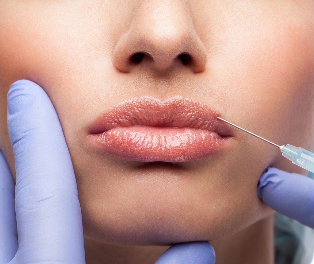 Форма губ Lips