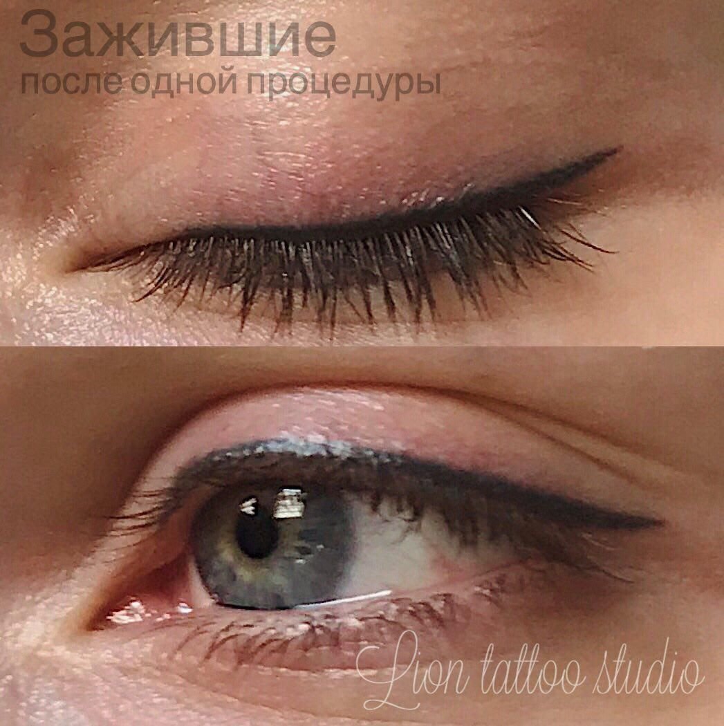 Заживление век после перманентного макияжа