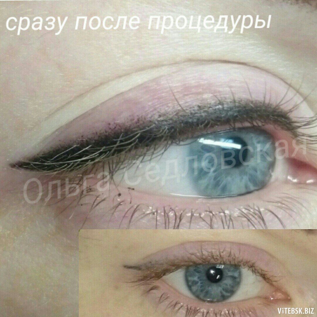 Перманентный макияж стрелки зажившие