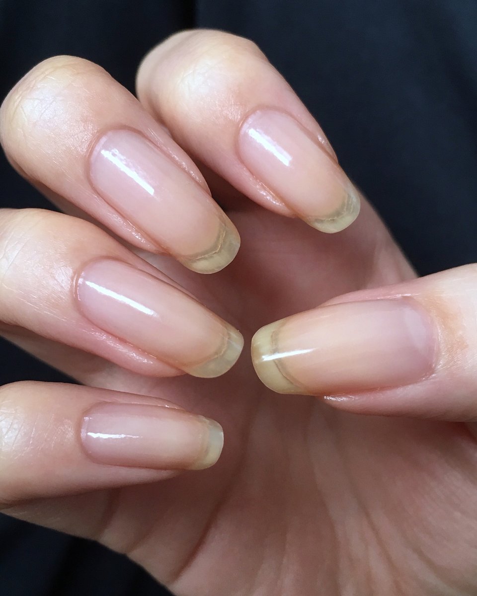 Essie Allure