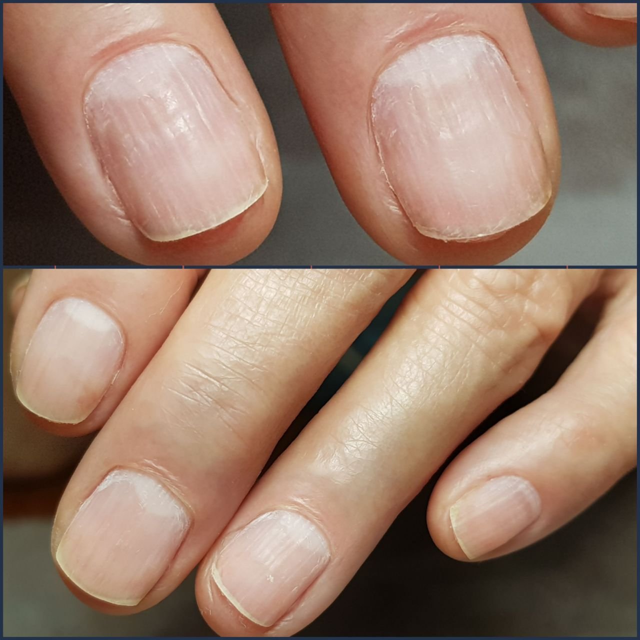 Ногти после аппаратного маникюра