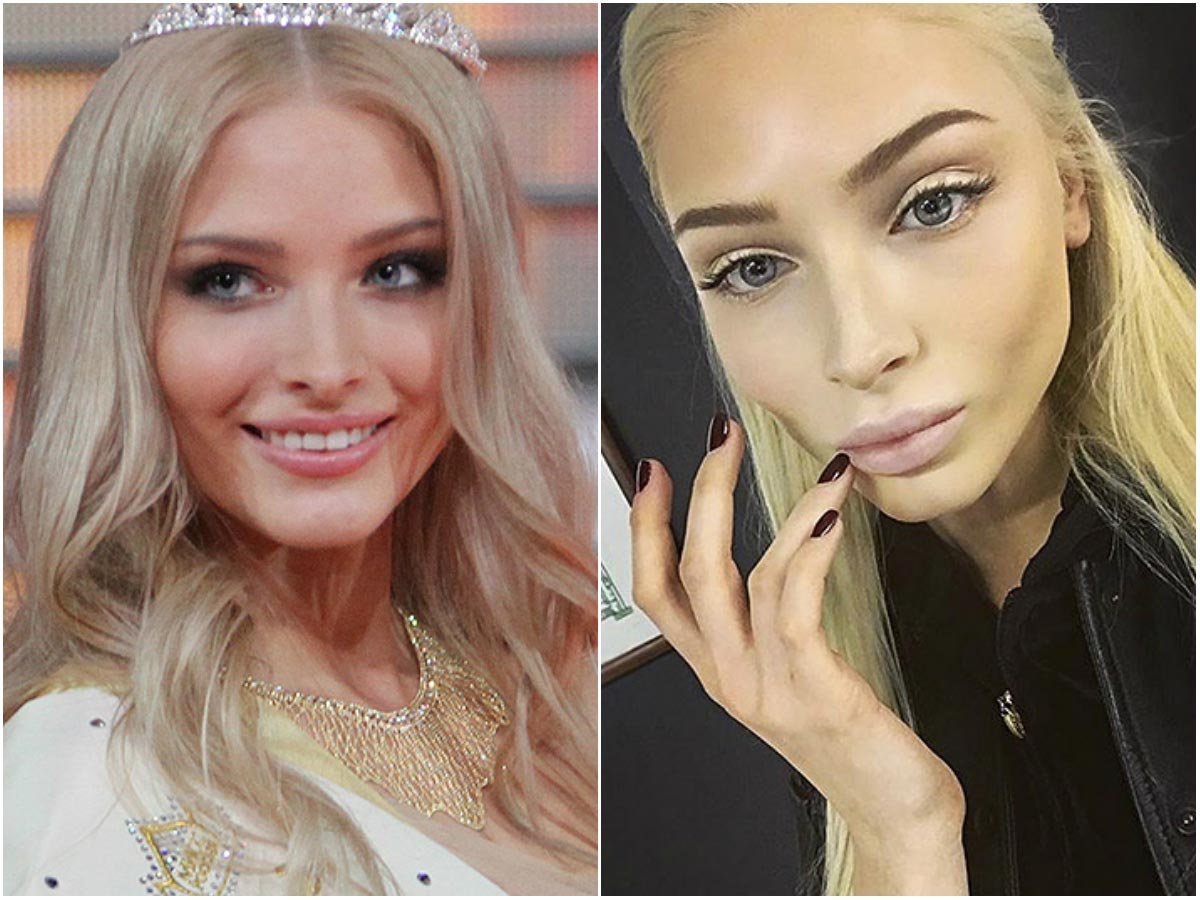 Алена Шишкова до