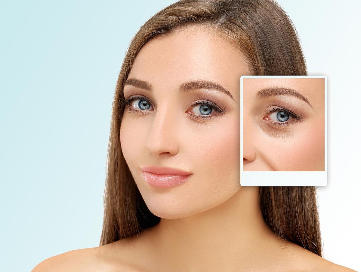 Cosmetic Eye Surgery