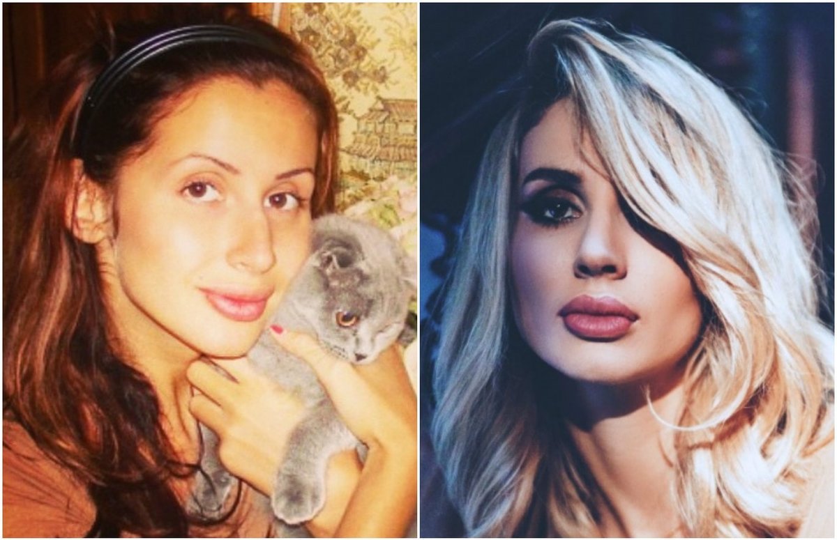 Светлана Лобода до пластики