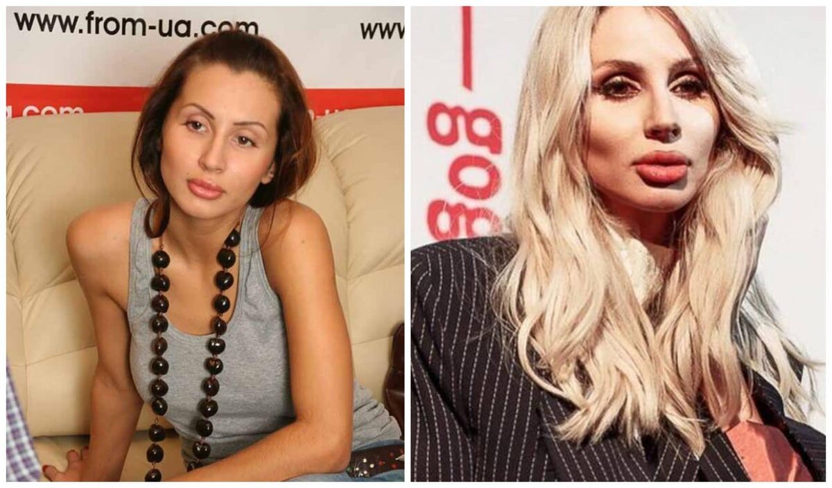 Светлана Лобода до пластики