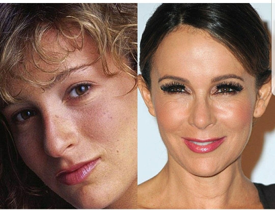 Актеры фото до и после пластики фото