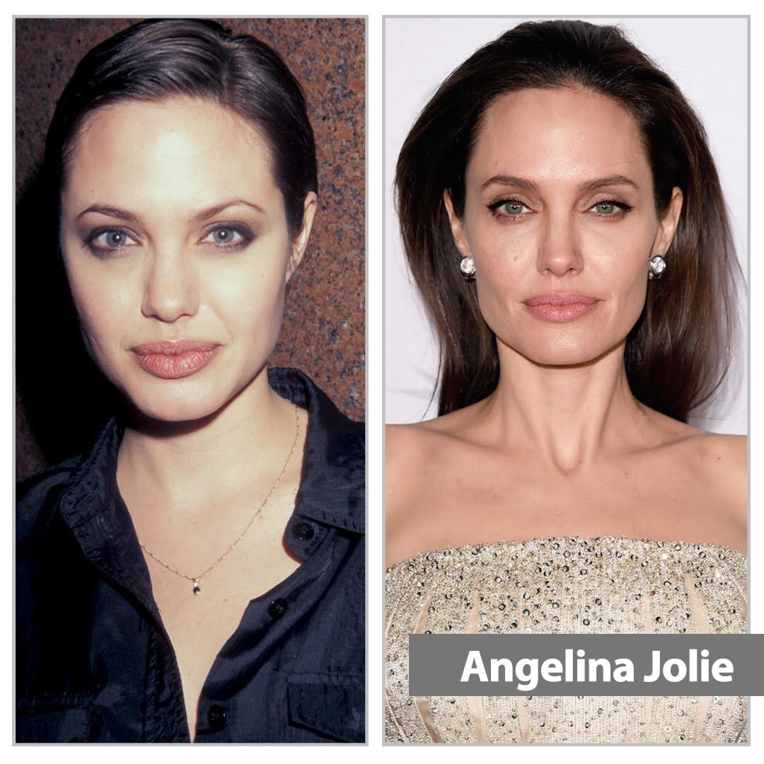 Анджелина Джоли до и после пластики