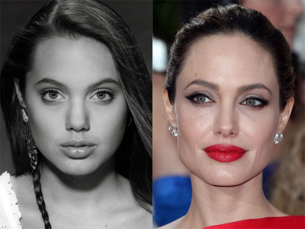 Анджелина Джоли после пластической операции