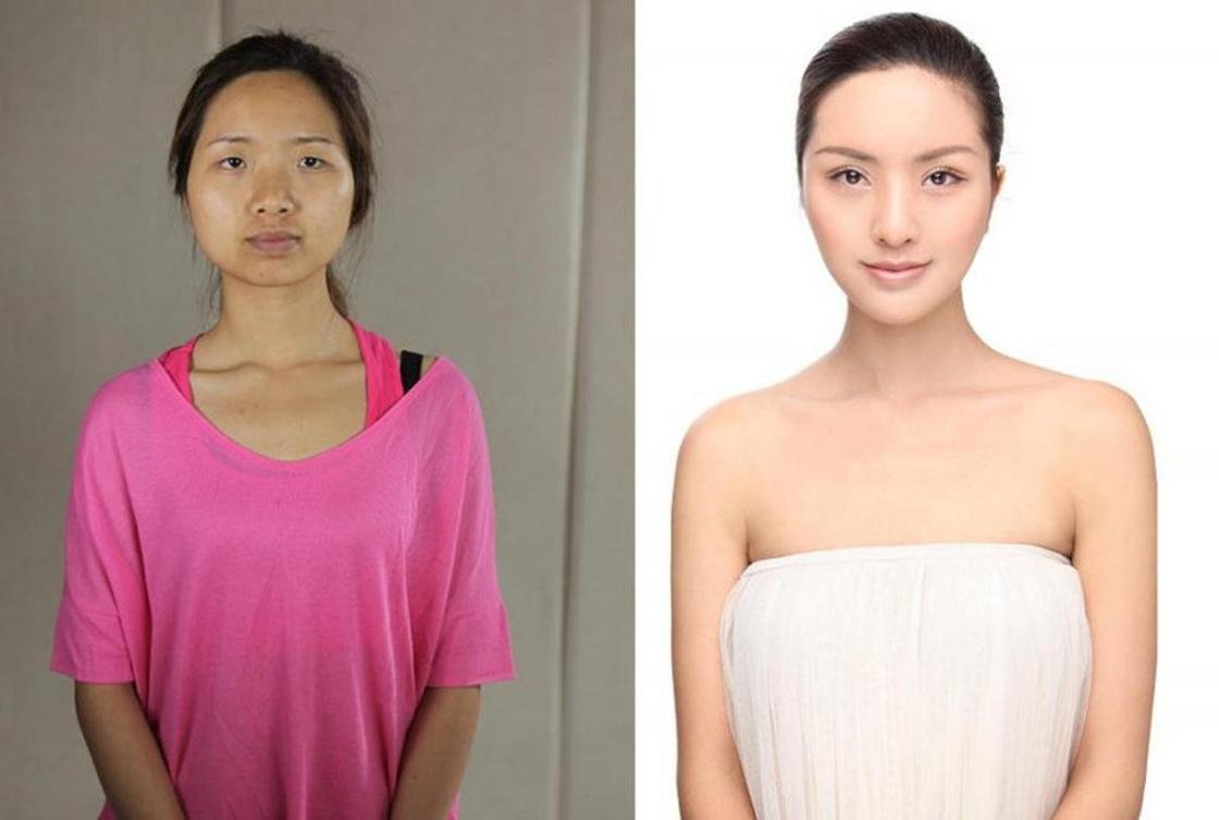 Китайский после. Сяо Фенг пластическая операция. Китаянки до и после пластики. Цвет кожи китайцев. Типичное азиатское лицо.