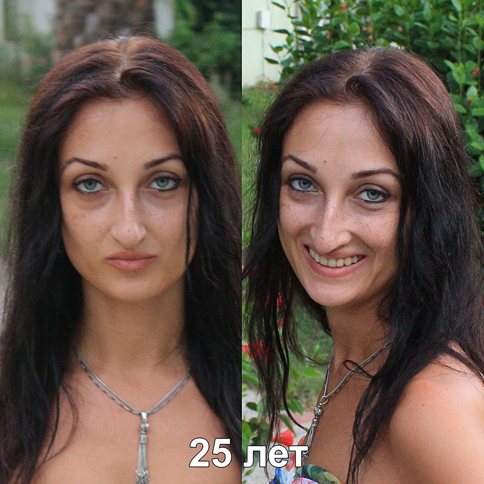 Лисьи глазки нитями фото до и после