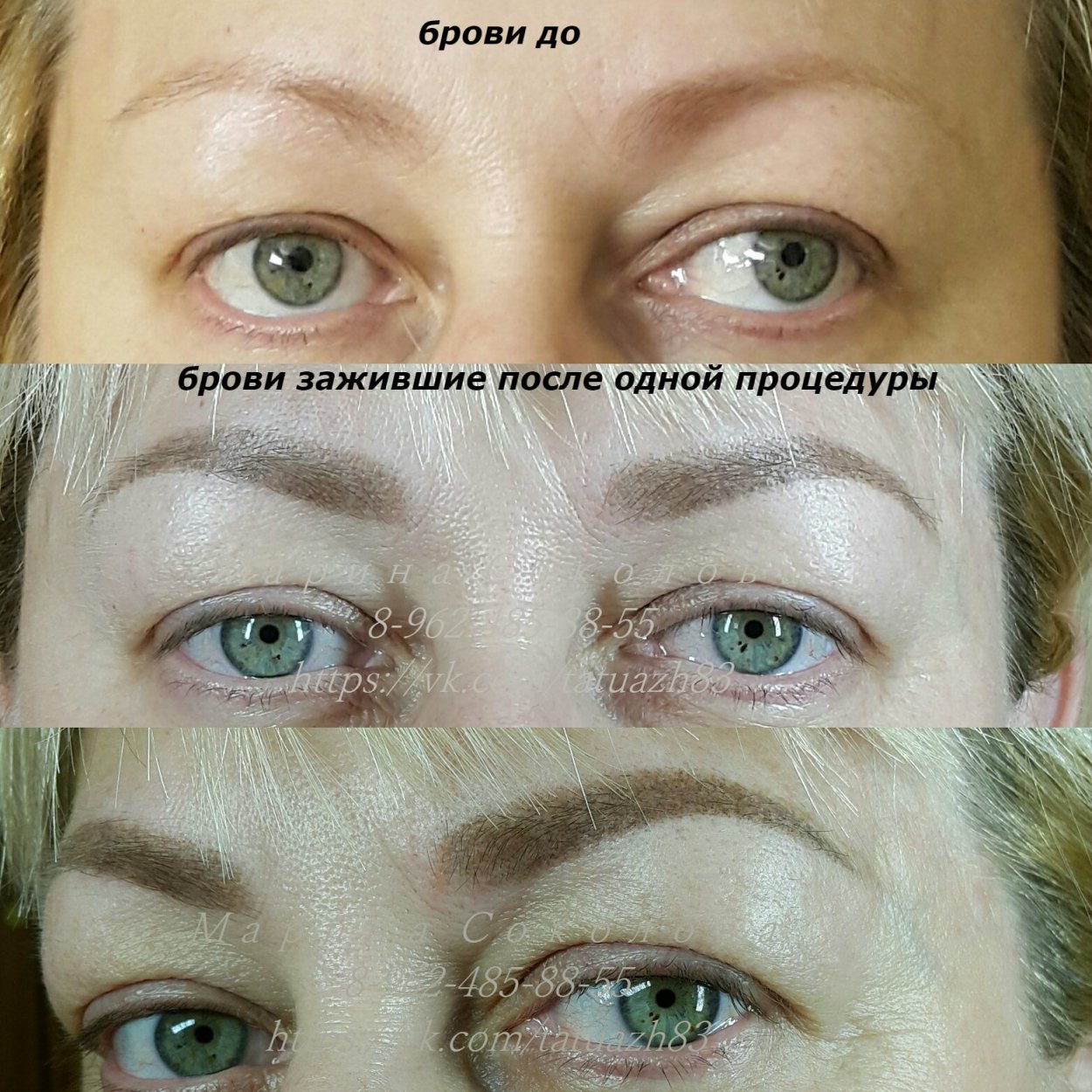 Зажившие брови после ПМ