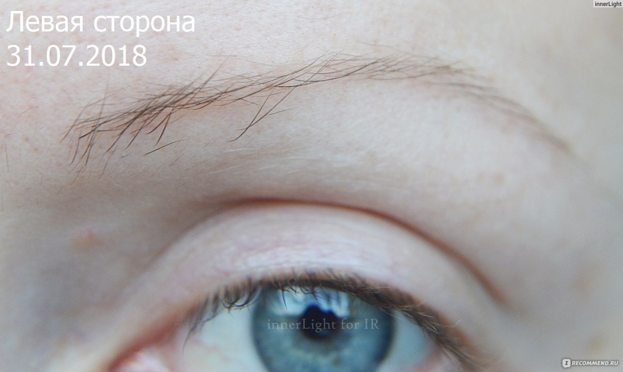 Никотиновая кислота для роста бровей