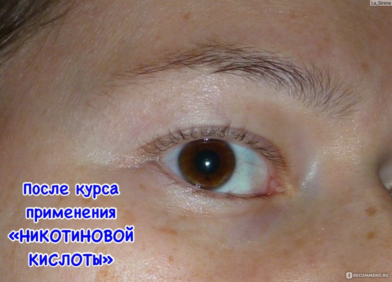 Никотиновая кислота для ресниц и бровей