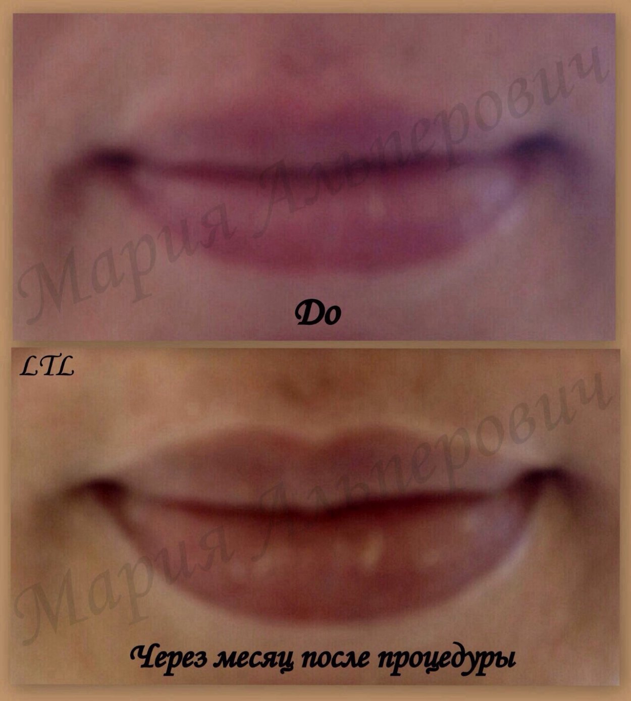татуаж губ после процедуры фото