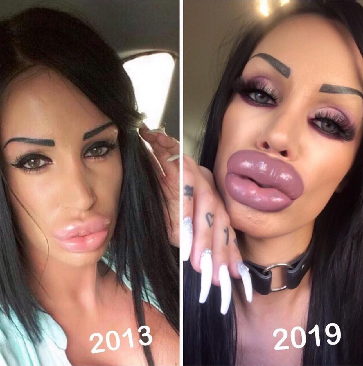 Увеличенные губы красивые
