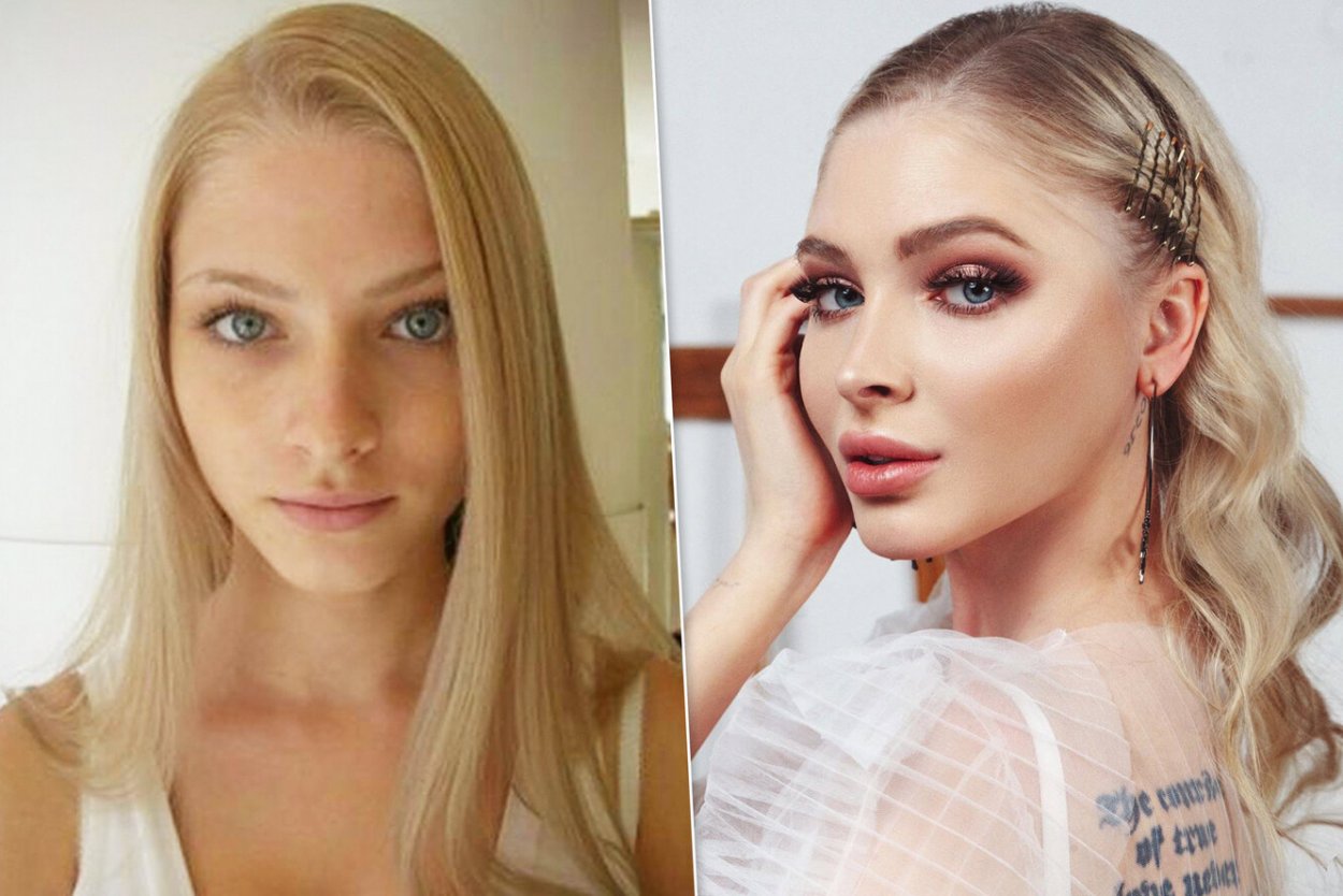 Алена Шишкова до пластики