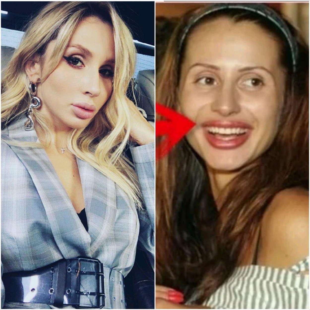 Анна Седокова до пластики