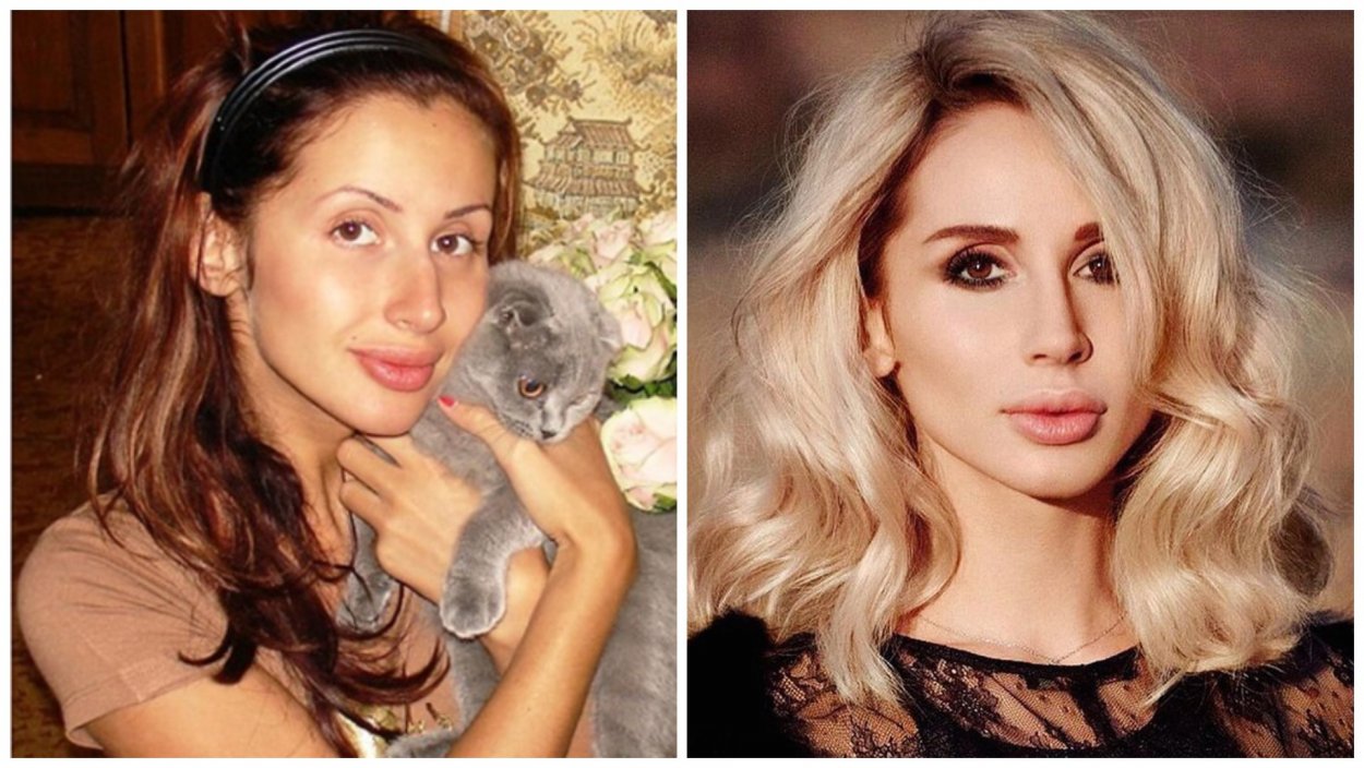 Светлана Лобода губы