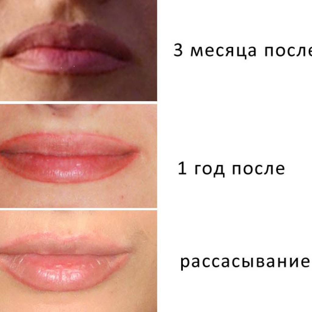Губы после перманентного макияжа