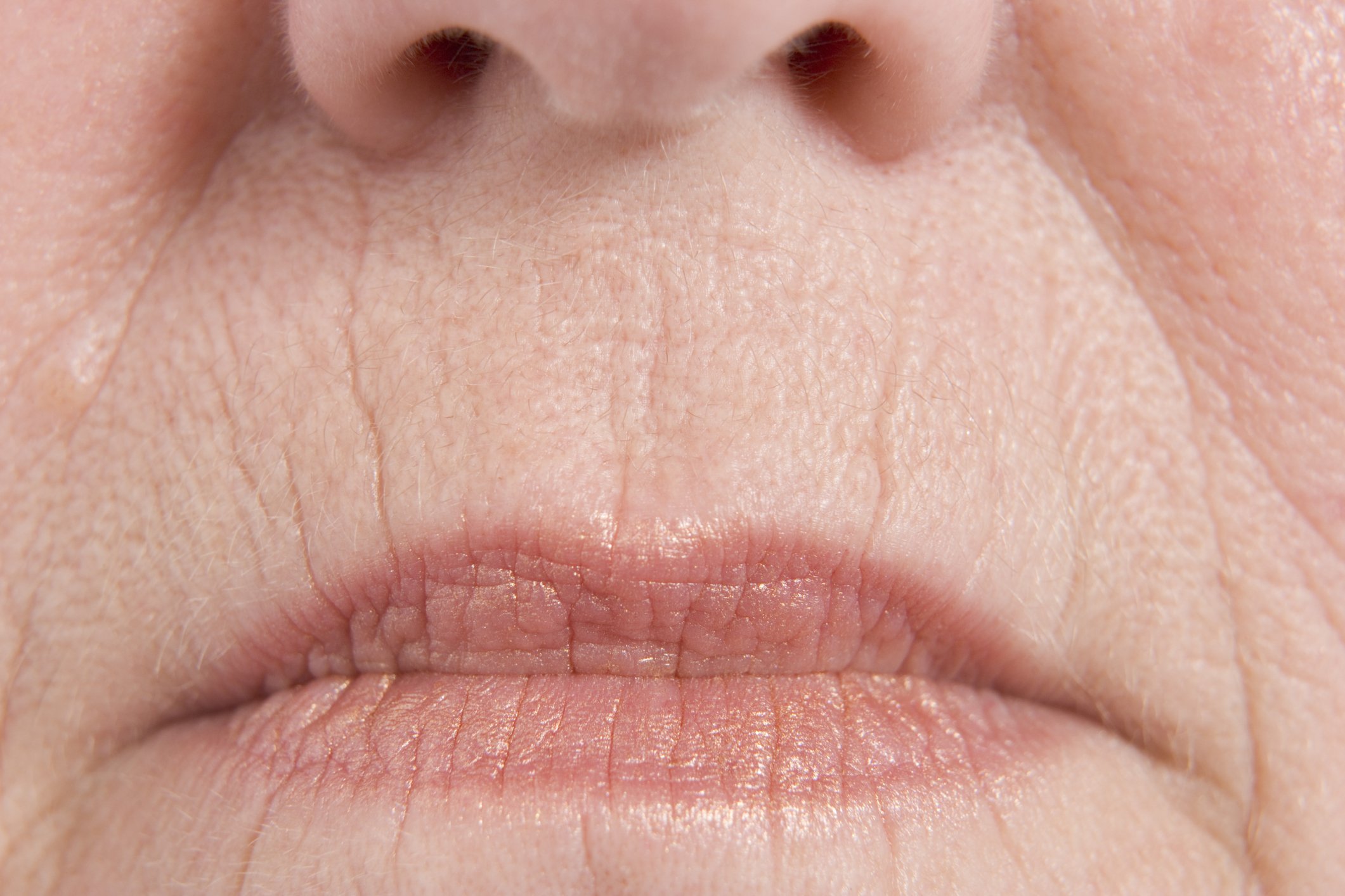 Складки углы рта. Кисетные морщины вокруг губ. Кисетные складки вокруг губ.