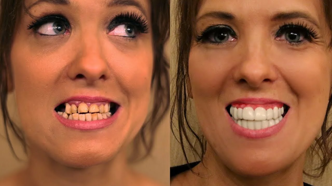 Видны передние зубы