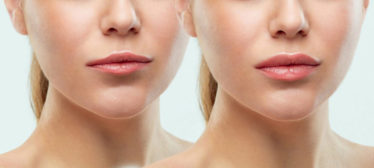Lips files before after