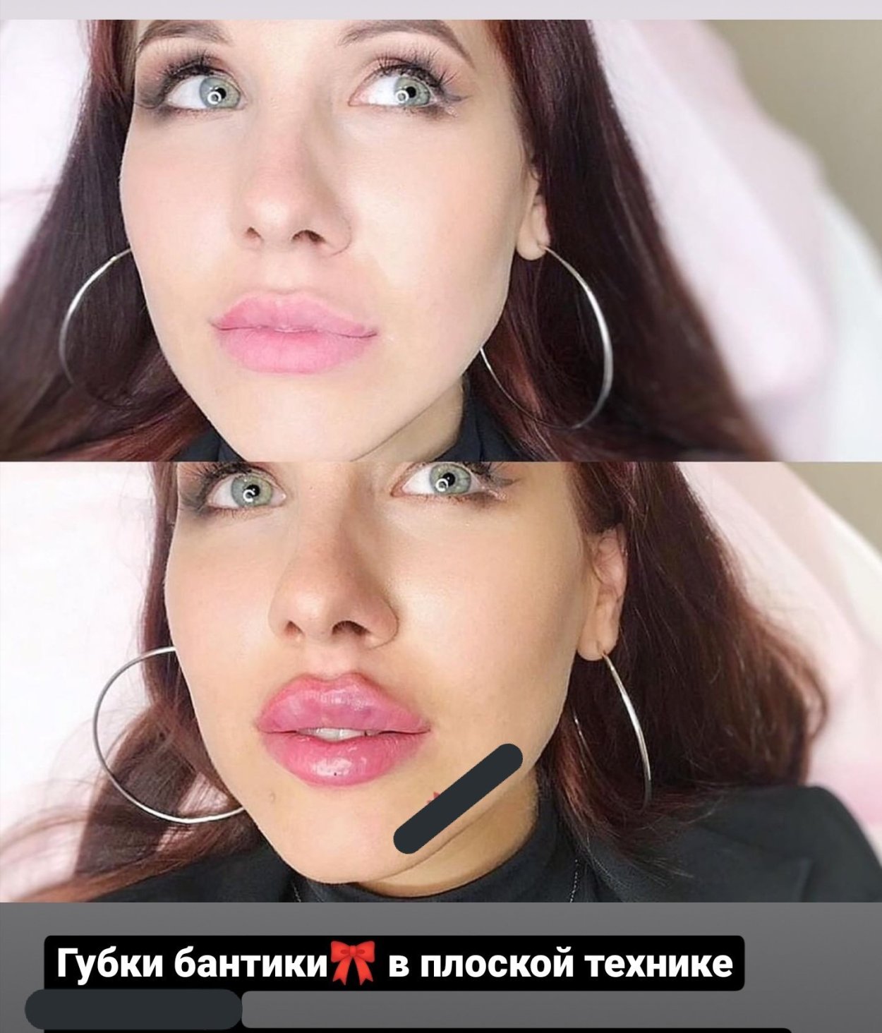 Техника увеличения губ бантиком
