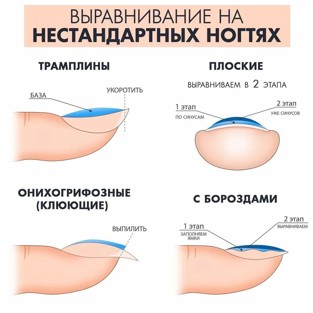 Выравнивание ногтевой пластины схема