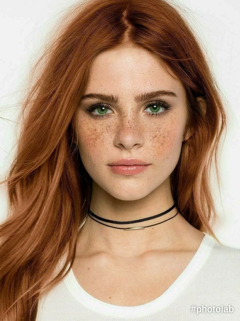 Селина Скиндер веснушки