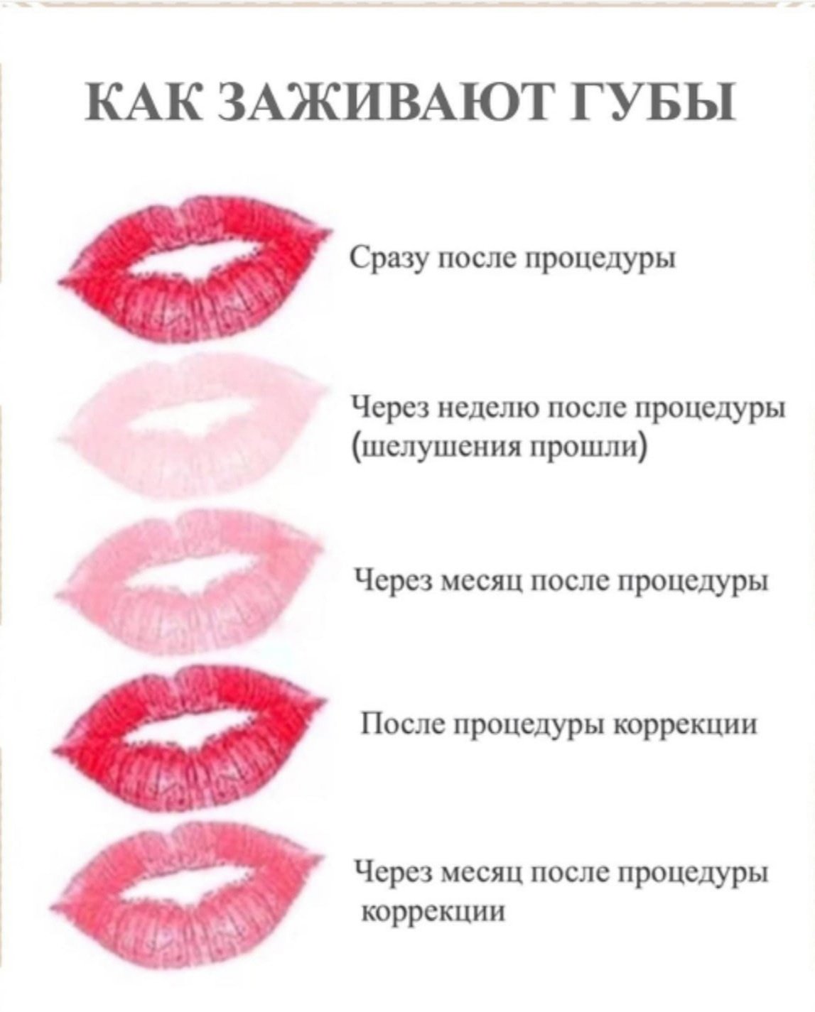 Этапы заживления перманентного макияжа губ