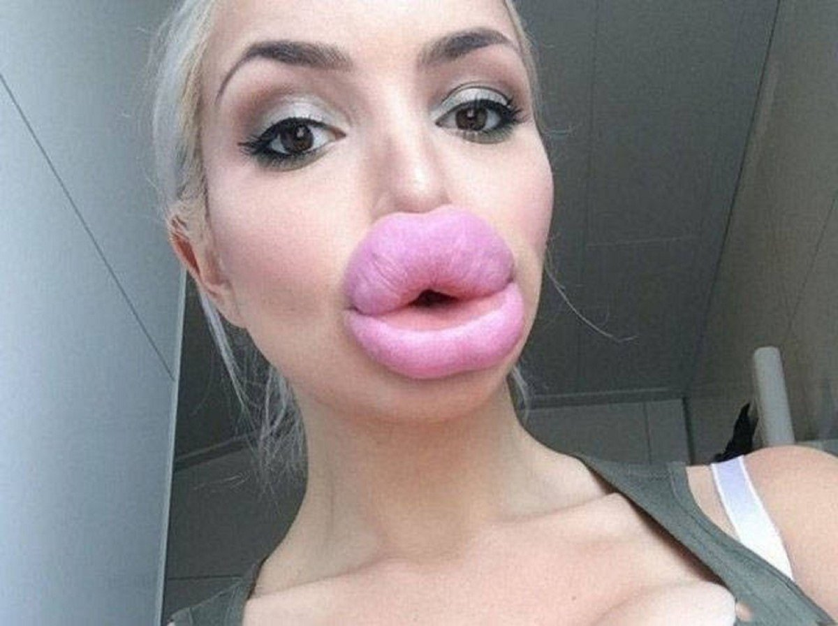 Накаченные губы