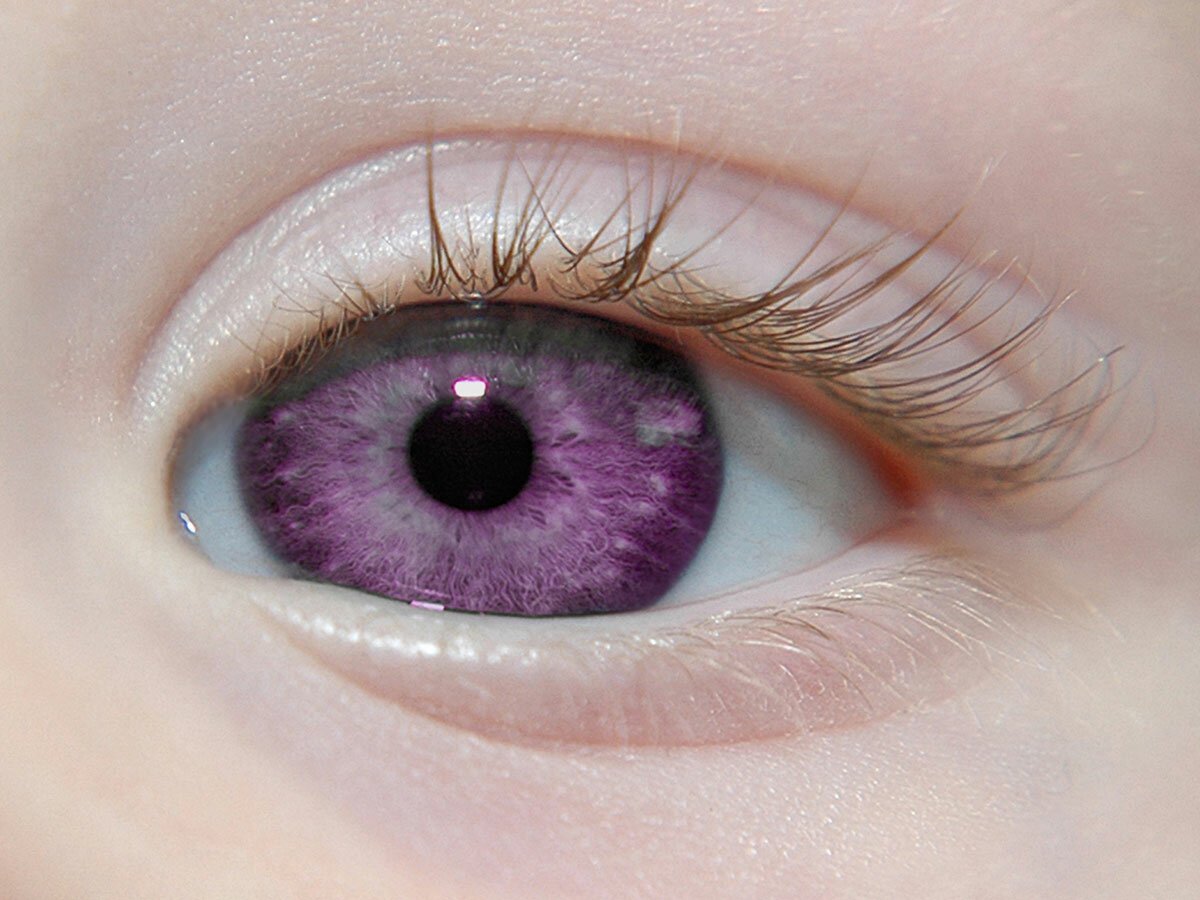 Фиолетовый цвет глаз от природы