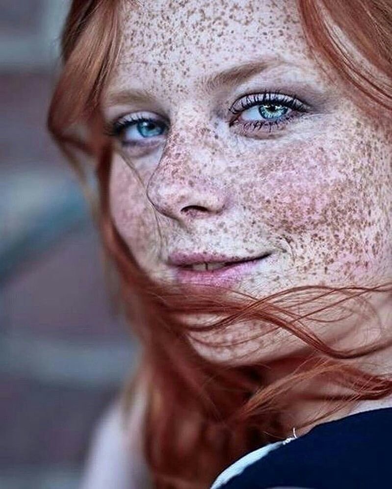 Селина Скиндер веснушки