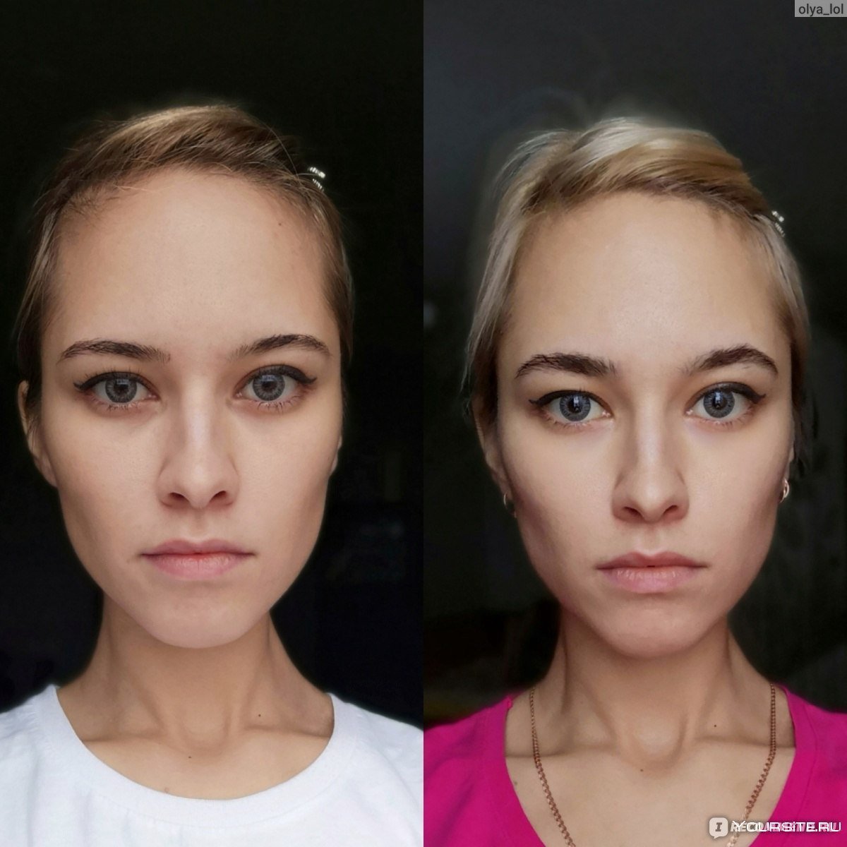 Приподнятые скулы