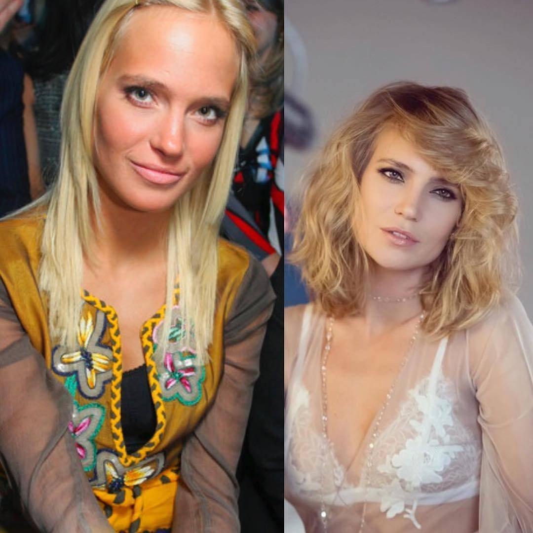 Глюкоза певица до пластики