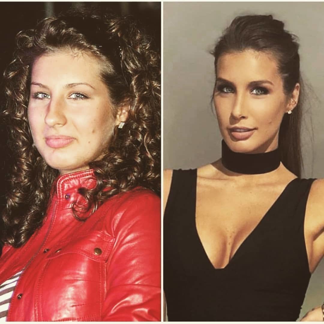 Кэти Топурия до пластики