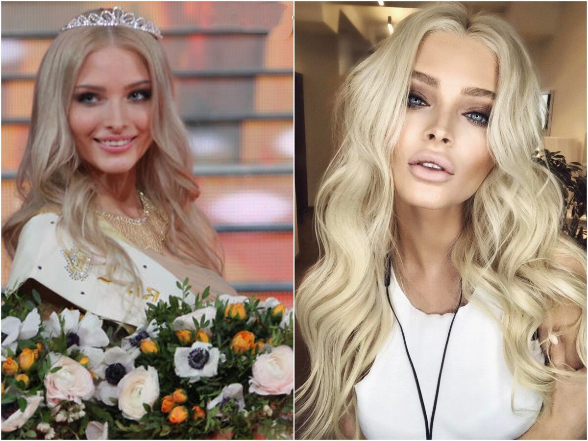 Шишкова пластики Алена