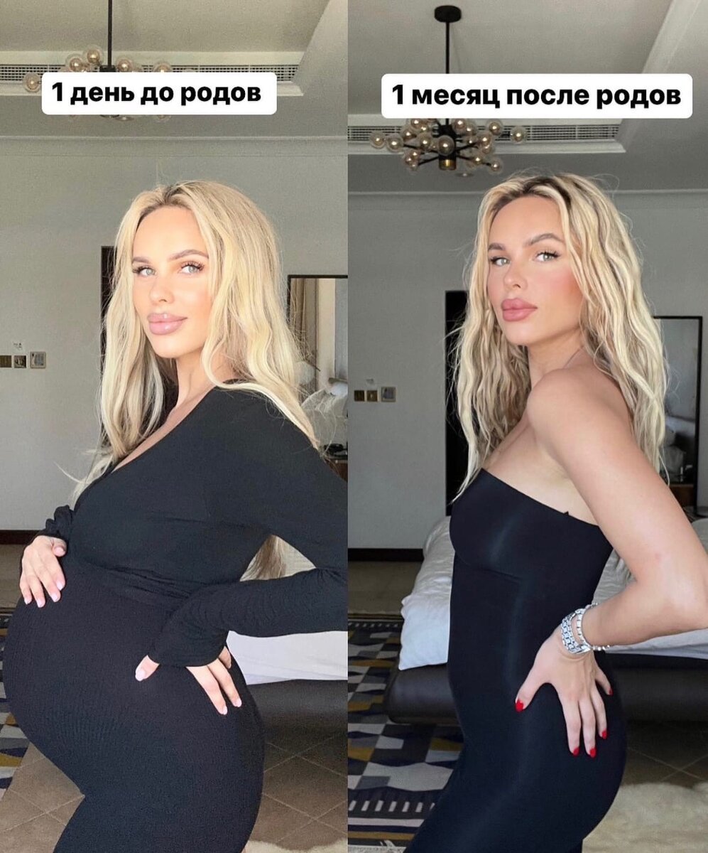 Певица ханна до операции