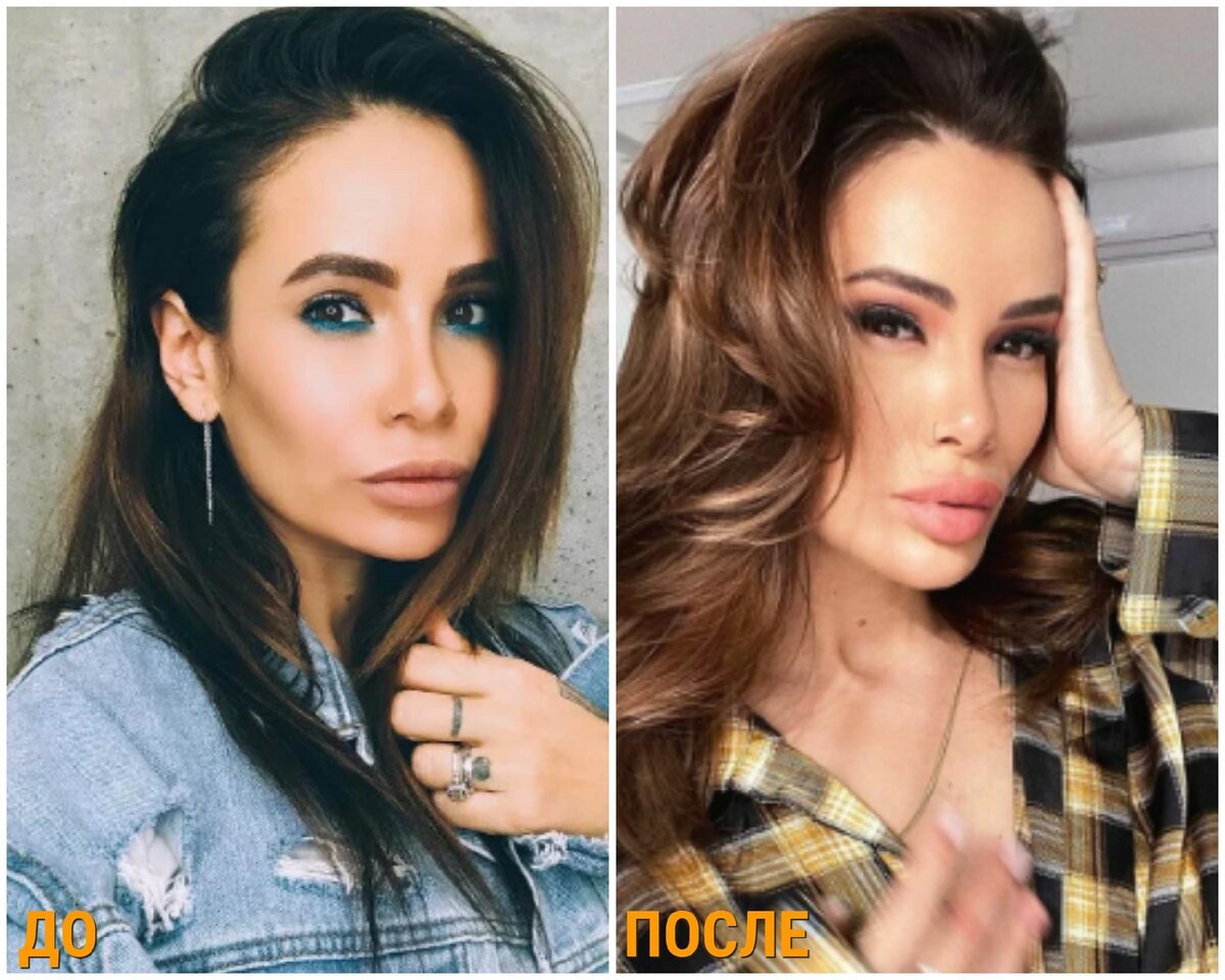Айза Анохина до пластики 2000