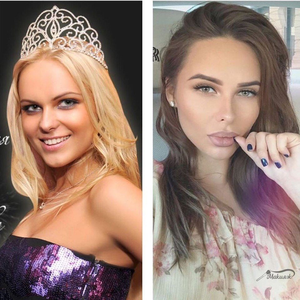 Ханна певица до и после