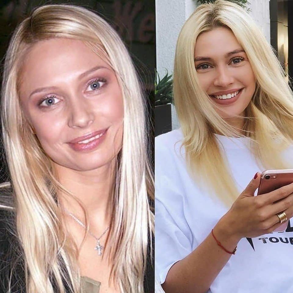 Наталья Рудова тогда и сейчас