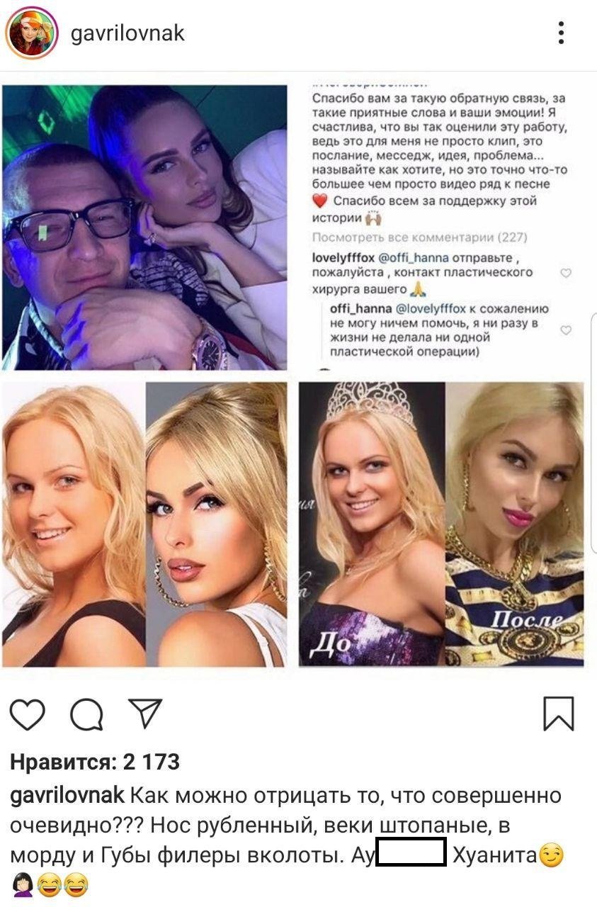 Певица Ханна до пластики