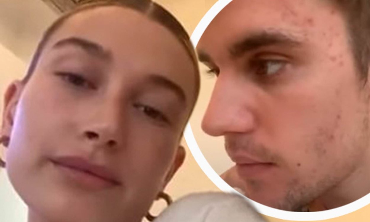 Хейли Бибер без макияжа и фотошопа