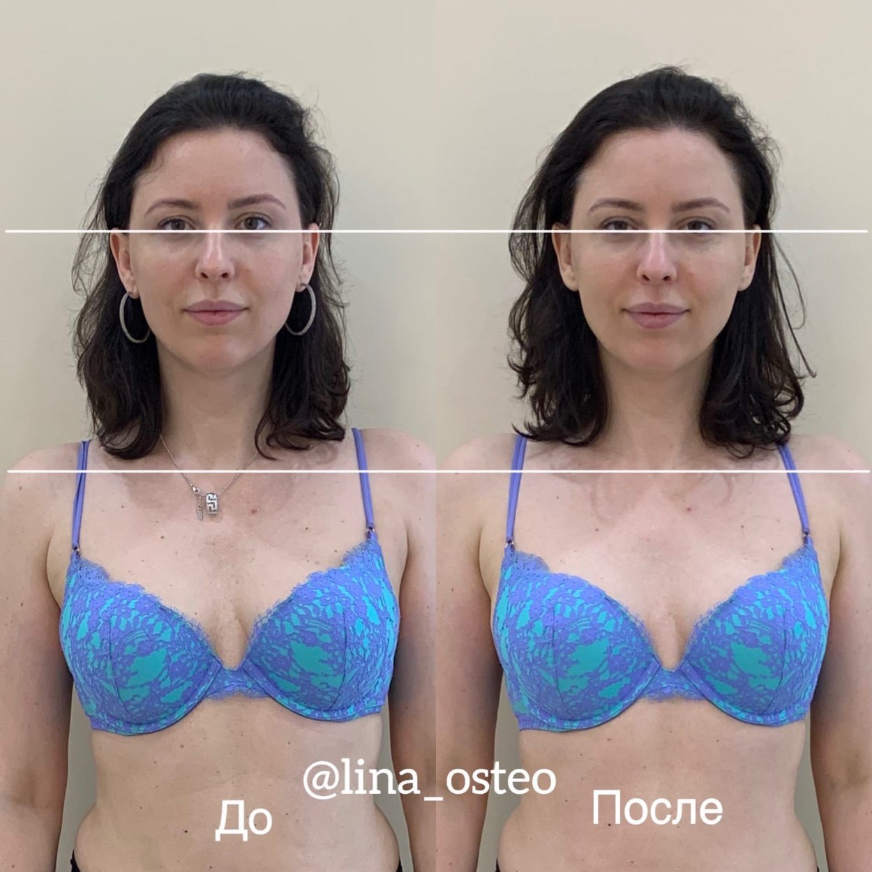 Асимметрия лица психосоматика