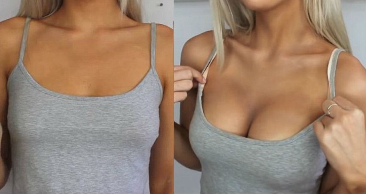 Увеличенная грудь
