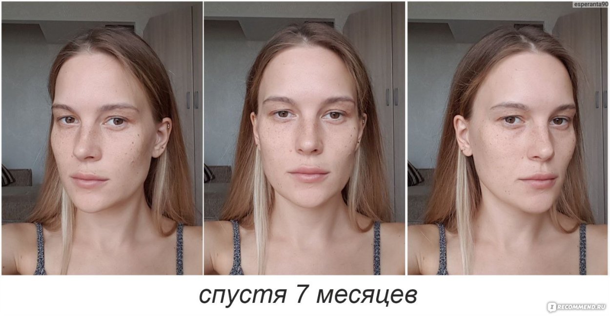 Улыбка со скулами