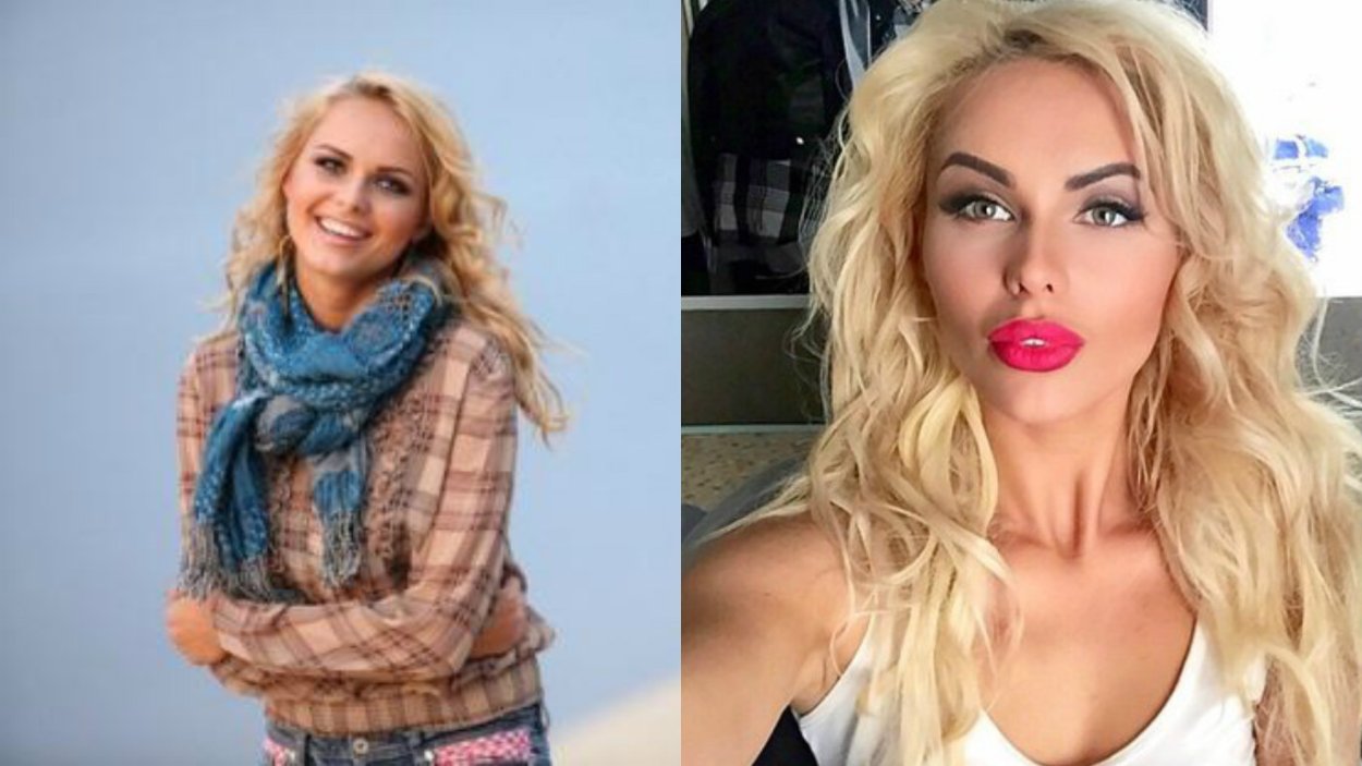 Анна Иванова Ханна до пластики