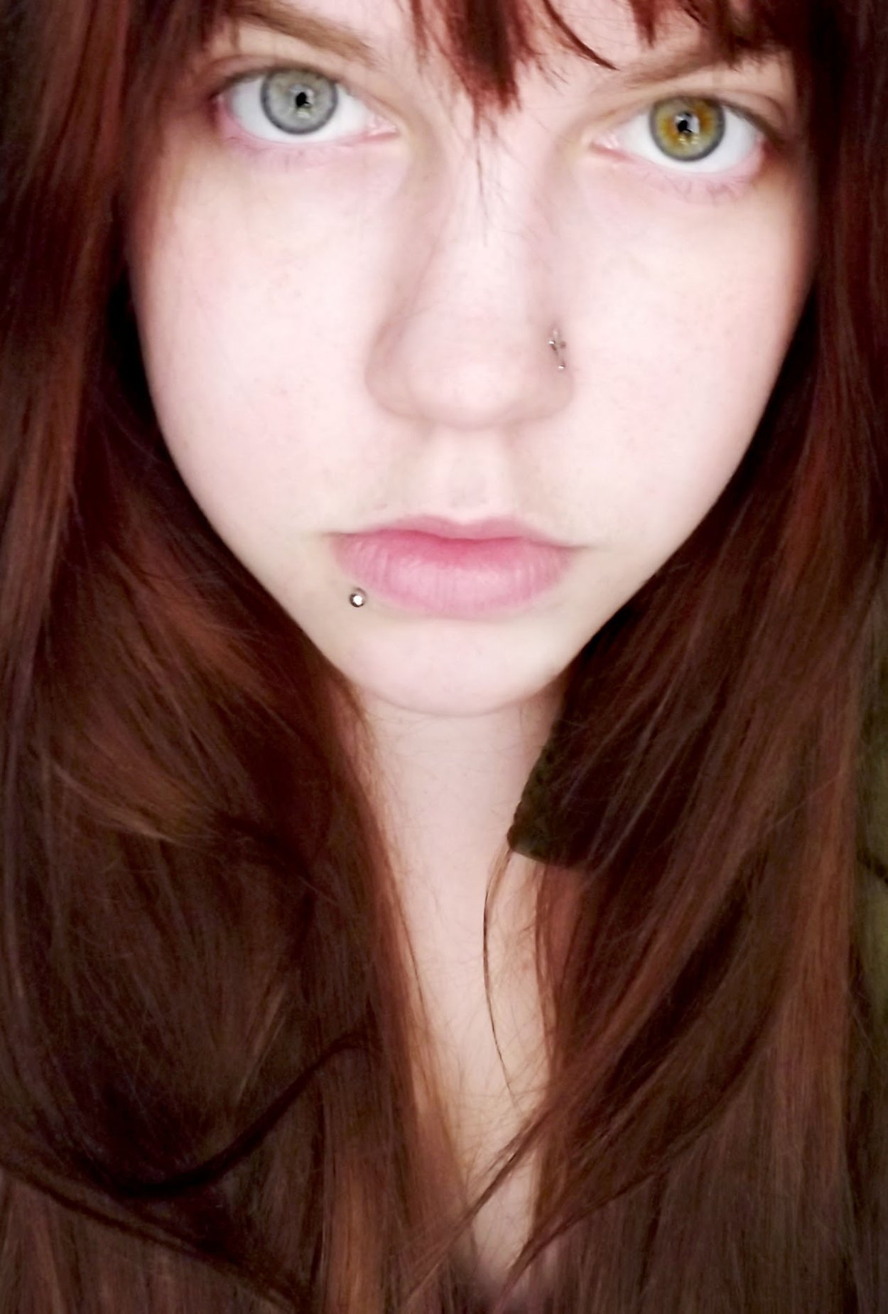 Heterochromia Iridum
